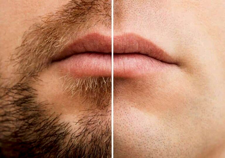 Dejarte crecer mumbai barba